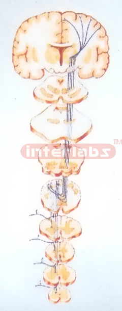 HANGING PROPRIOCEPTION AND REFINED TACTILE SENSATION PATHWAY MODEL OF TRUNK AND LIMBS